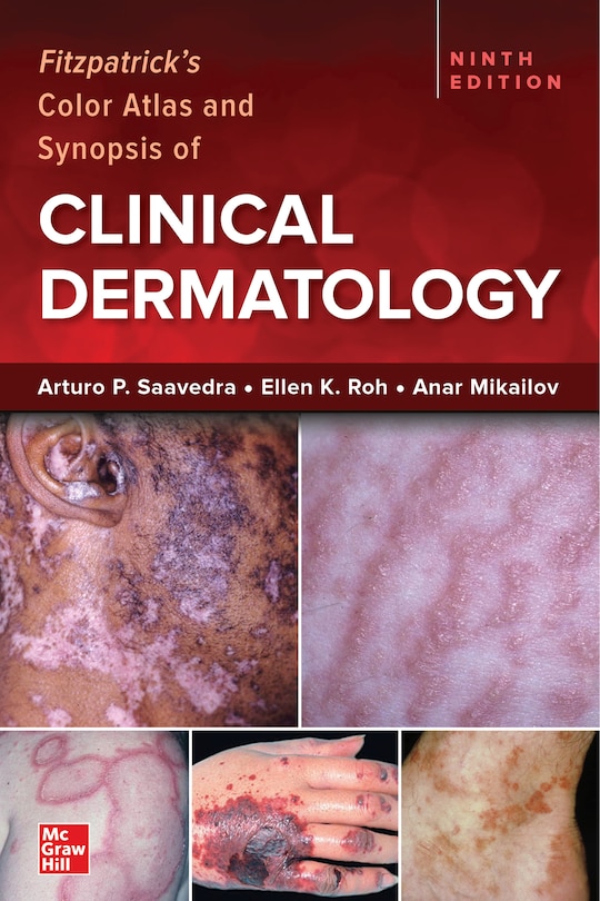 Front cover_Fitzpatrick's Color Atlas and Synopsis of Clinical Dermatology, Ninth Edition