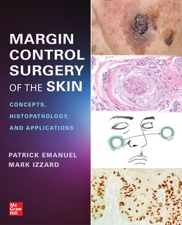 Couverture_Margin Control Surgery of the Skin: Concepts, Histopathology, and Applications