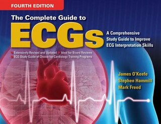 The Complete Guide To Ecgs: A Comprehensive Study Guide To Improve Ecg Interpretation Skills
