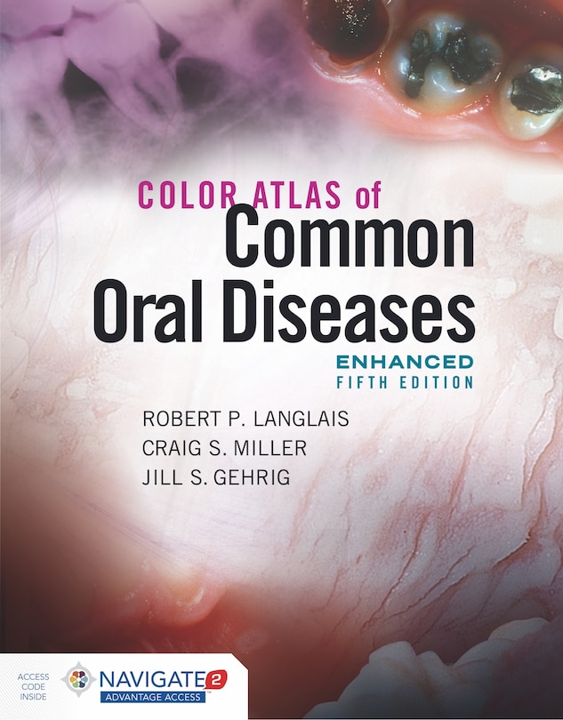 Couverture_Color Atlas of Common Oral Diseases, Enhanced Edition