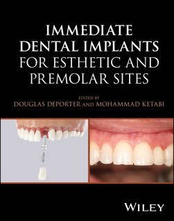 Couverture_Immediate Dental Implants for Esthetic and Premolar Sites