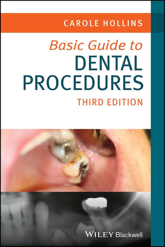 Front cover_Basic Guide to Dental Procedures