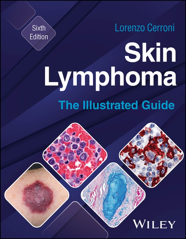 Front cover_Skin Lymphoma