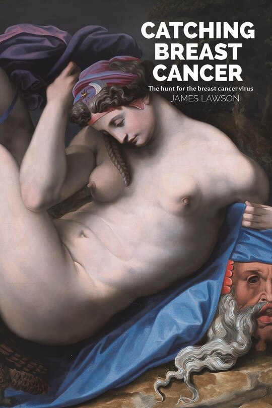 Couverture_Catching Breast Cancer