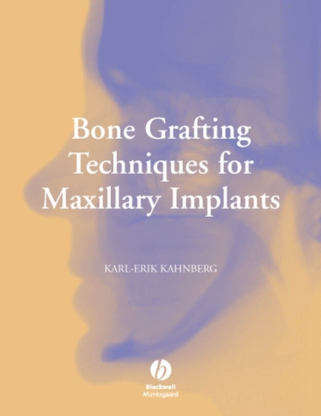 Couverture_Bone Grafting Techniques for Maxillary Implants