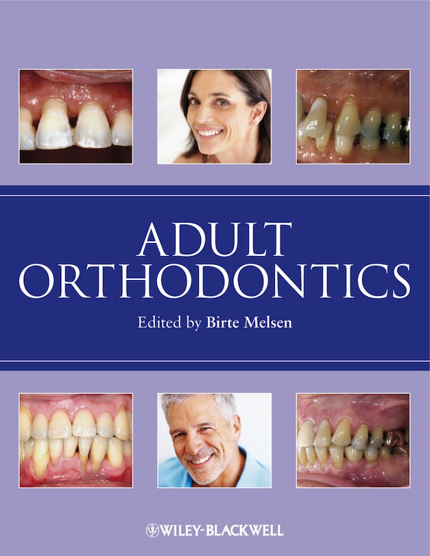 Couverture_Adult Orthodontics