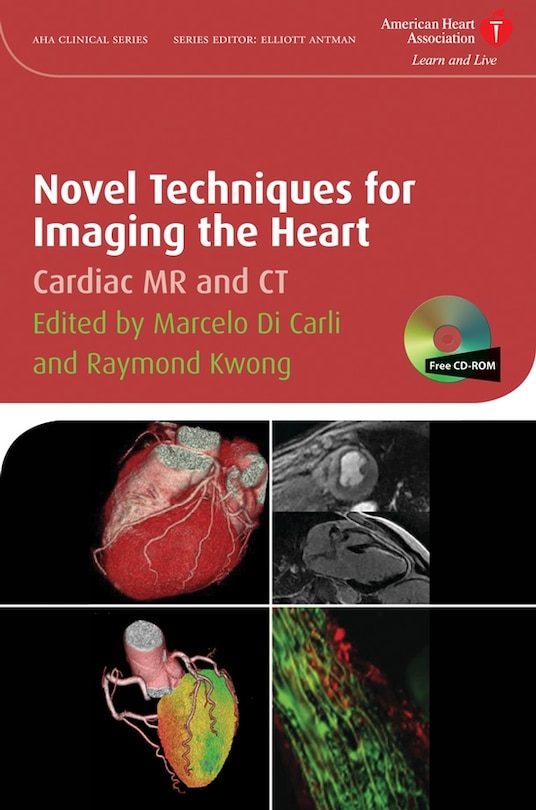 Front cover_Novel Techniques for Imaging the Heart