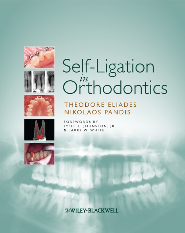Front cover_Self-Ligation in Orthodontics