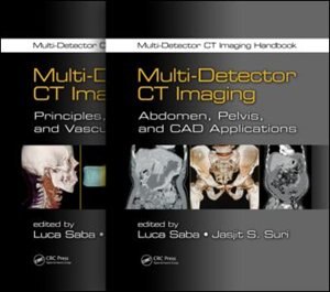 Front cover_Multi-detector Ct Imaging Handbook, Two Volume Set