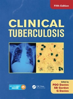 Front cover_Clinical Tuberculosis
