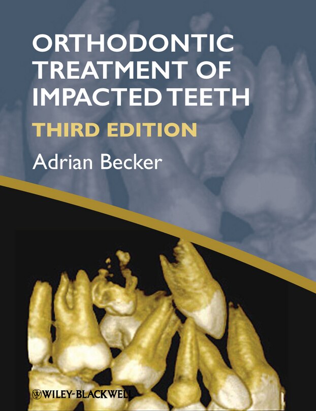Couverture_Orthodontic Treatment of Impacted Teeth