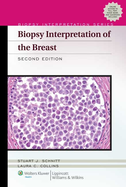Couverture_Biopsy Interpretation Of The Breast