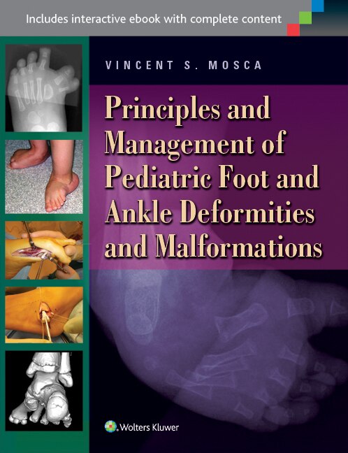 Front cover_Foot and Deformities and Malformations in Children