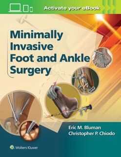 Front cover_Minimally Invasive Foot And Ankle Surgery