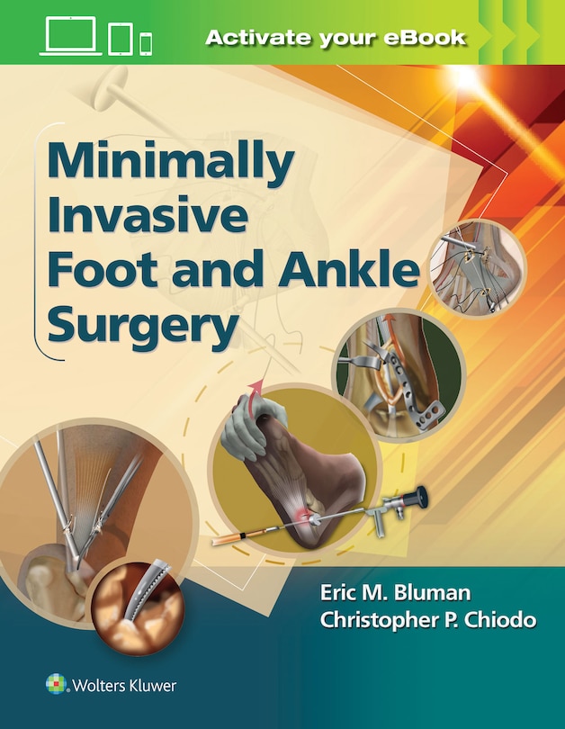 Front cover_Minimally Invasive Foot And Ankle Surgery