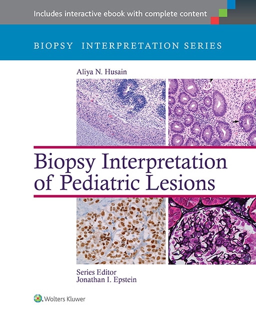 Couverture_Biopsy Interpretation of Pediatric Lesions