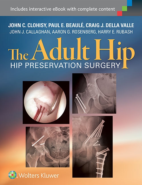 Front cover_The Adult Hip