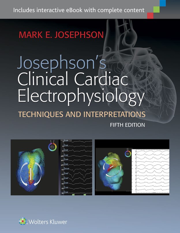 Front cover_Josephson's Clinical Cardiac Electrophysiology