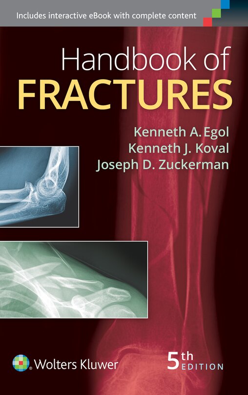 Front cover_Handbook Of Fractures