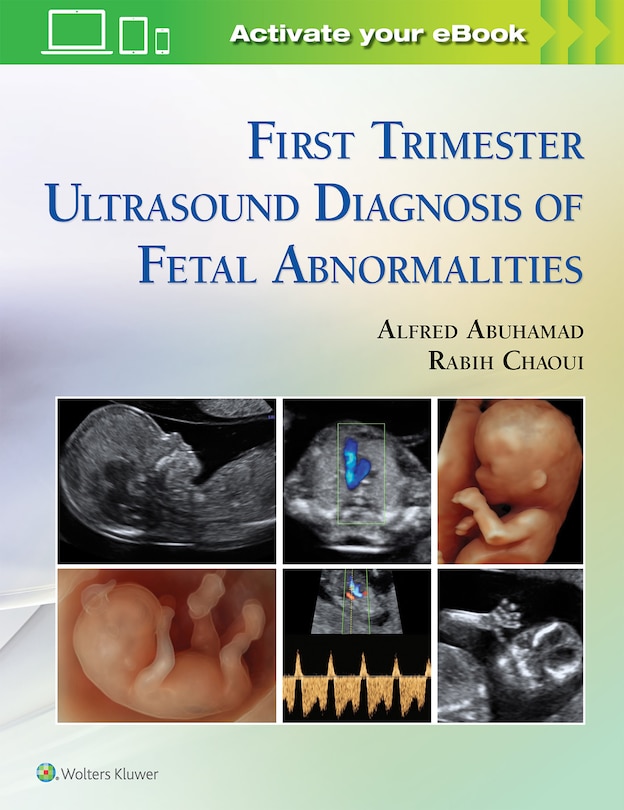 Front cover_First Trimester Ultrasound Diagnosis Of Fetal Abnormalities