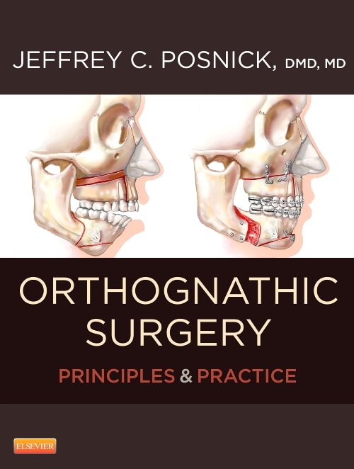 Front cover_Orthognathic Surgery - 2 Volume Set