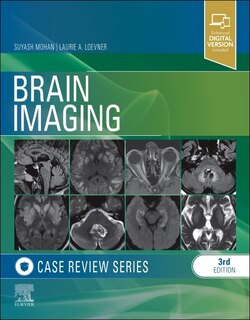 Front cover_Brain Imaging