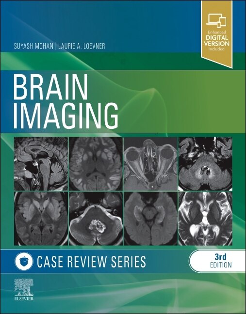 Front cover_Brain Imaging