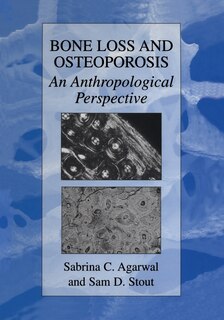 Bone Loss and Osteoporosis: An Anthropological Perspective