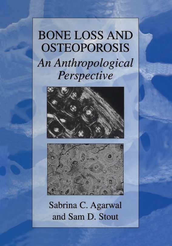 Couverture_Bone Loss and Osteoporosis