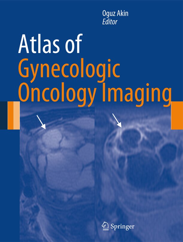 Front cover_Atlas of Gynecologic Oncology Imaging