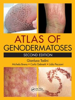 Front cover_Atlas Of Genodermatoses