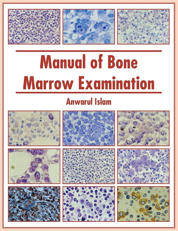 Front cover_Manual Of Bone Marrow Examination