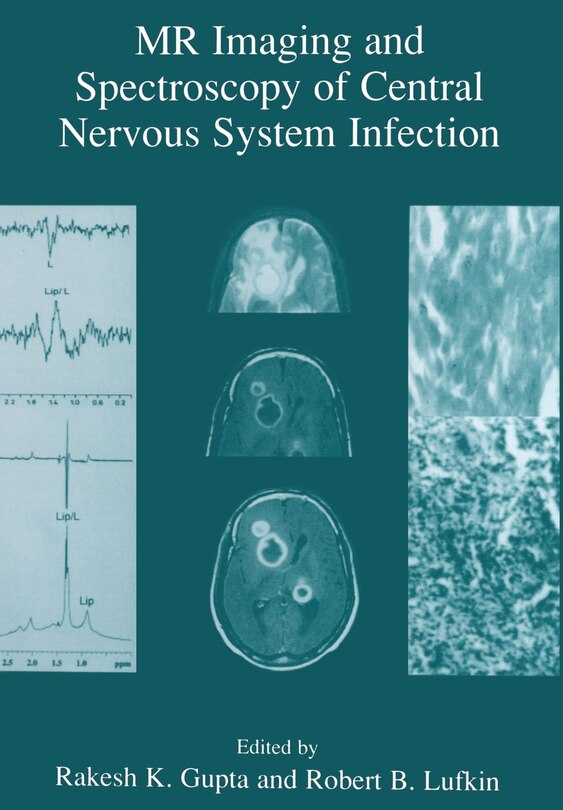 Couverture_MR Imaging and Spectroscopy of Central Nervous System Infection