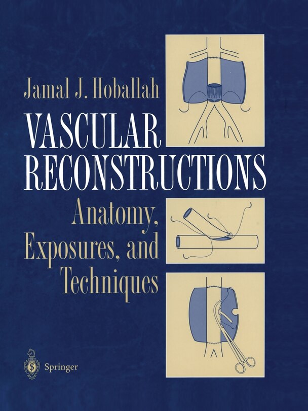 Front cover_Vascular Reconstructions