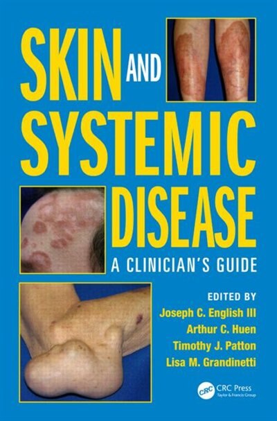 Front cover_Skin And Systemic Disease