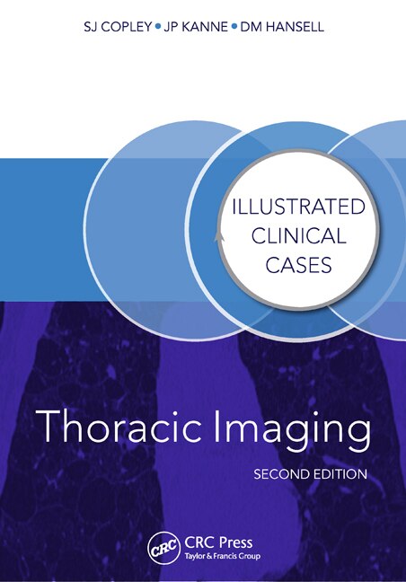 Couverture_Thoracic Imaging