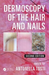 Couverture_Dermoscopy Of The Hair And Nails