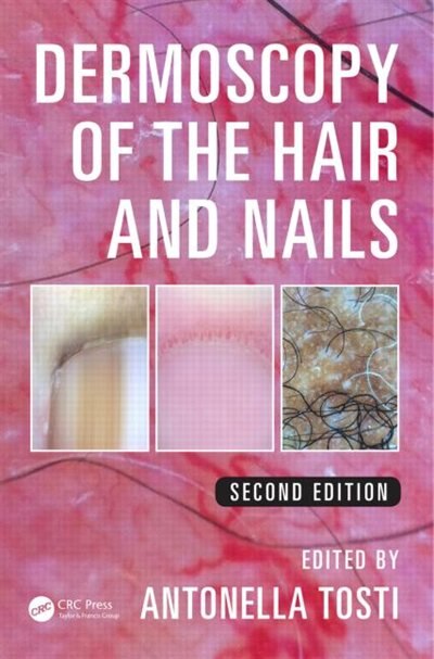 Couverture_Dermoscopy Of The Hair And Nails