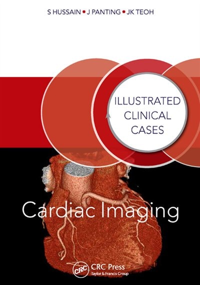 Couverture_Cardiac Imaging