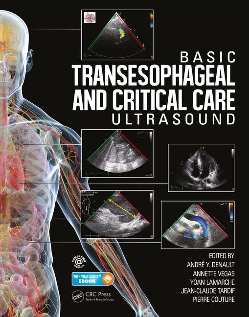Couverture_Basic Transesophageal And Critical Care Ultrasound
