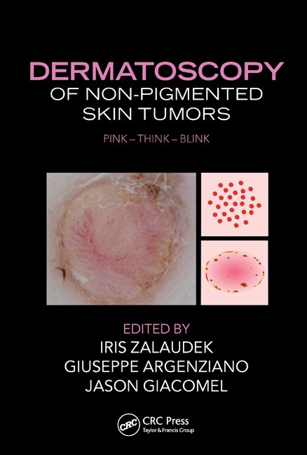 Front cover_Dermatoscopy Of Non-pigmented Skin Tumors