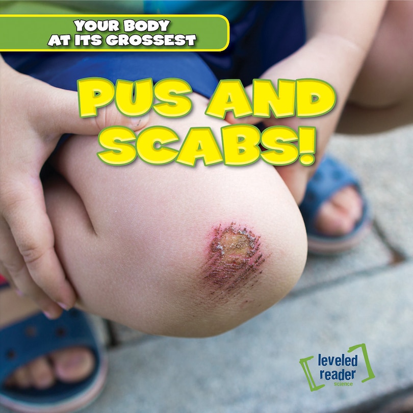 Front cover_Pus and Scabs!