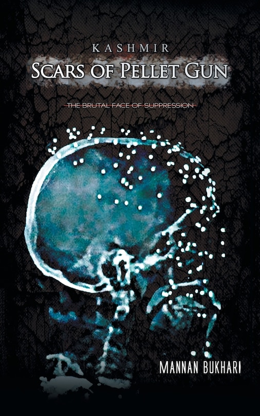 Couverture_Kashmir - Scars of Pellet Gun