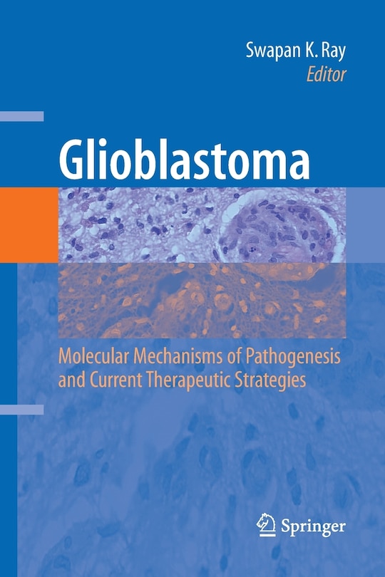Front cover_Glioblastoma: