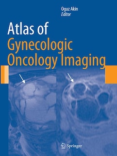 Front cover_Atlas Of Gynecologic Oncology Imaging