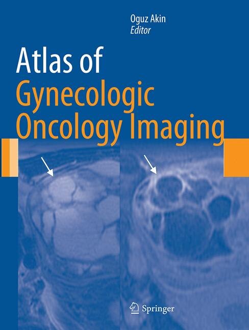 Front cover_Atlas Of Gynecologic Oncology Imaging