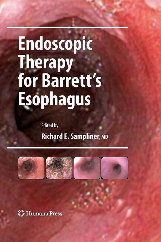 Front cover_Endoscopic Therapy For Barrett's Esophagus