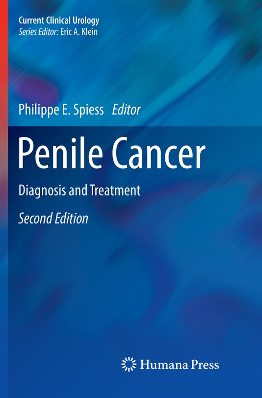 Penile Cancer: Diagnosis And Treatment