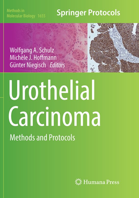Couverture_Urothelial Carcinoma
