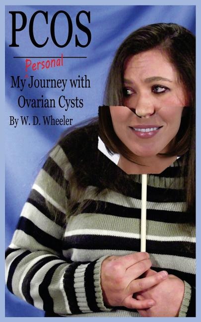 Pcos: My (Personal) Journey with Ovarian Cysts